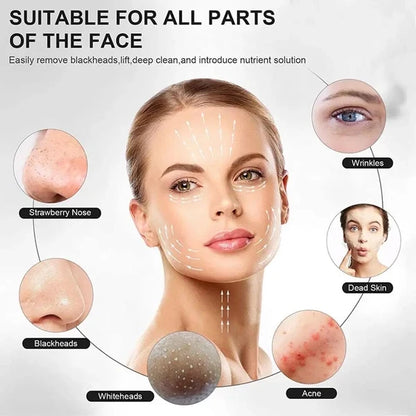 Shovel Skin Scrubber, Deep Vibrate Facial Cleaner, Ultrasonic Face Spatula, Peeling Blackhead Remover Facial Massager, Facial Skin Ultrasonic Scrubber, Cavitation Vibration Peeling Massager, Acne Blackhead Remover, Deep Clean Beauty Instrument Device