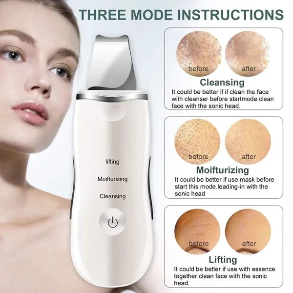 Shovel Skin Scrubber, Deep Vibrate Facial Cleaner, Ultrasonic Face Spatula, Peeling Blackhead Remover Facial Massager, Facial Skin Ultrasonic Scrubber, Cavitation Vibration Peeling Massager, Acne Blackhead Remover, Deep Clean Beauty Instrument Device