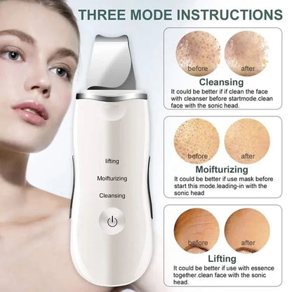 Shovel Skin Scrubber, Deep Vibrate Facial Cleaner, Ultrasonic Face Spatula, Peeling Blackhead Remover Facial Massager, Facial Skin Ultrasonic Scrubber, Cavitation Vibration Peeling Massager, Acne Blackhead Remover, Deep Clean Beauty Instrument Device