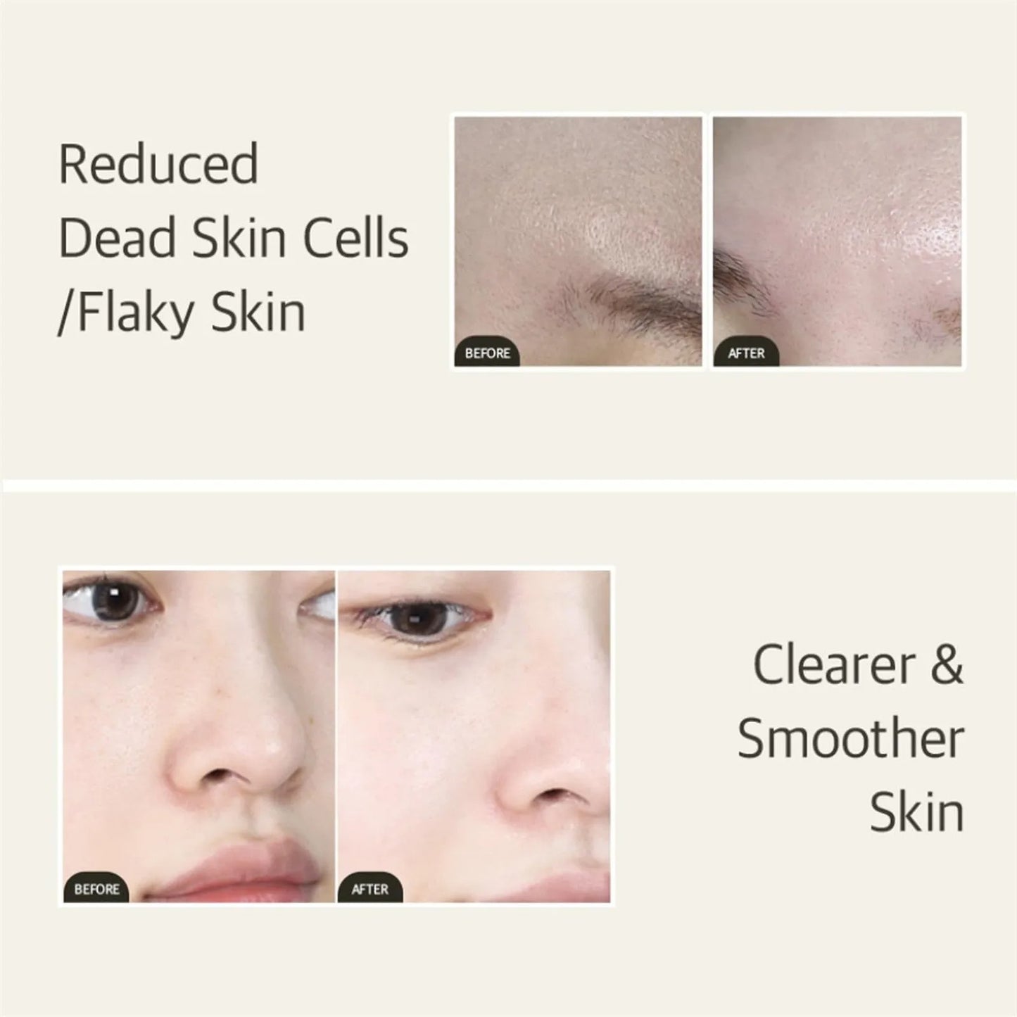 Mixsoon-fermented soybean exfoliating, antioxidant, brightening skin, moisturizing, elastic, firming, skin essence,